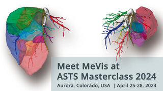 Meet MeVis at ASTS - Living Donor Liver Transplant Masterclass 2024