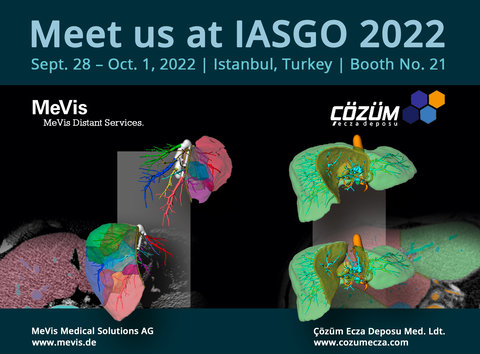 IASGO 2022 mit MeVis Medical Solutions AG und Çözüm Ecza
