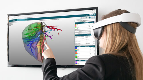 MeVis Distant Services (MDS) 3D-Anatomie und VR