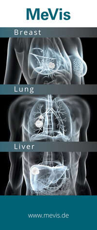 Treffen Sie MeVis Medical Solutions auf dem ECR 2024 in Wien, Österreich