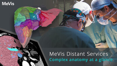 MeVis Distant Services - Complex Anatomy at a Glance