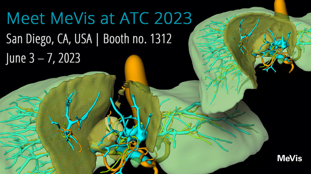 Meet MeVis Medical Solutions AG at ATC 2023 in San Diego, USA.
