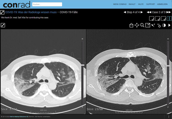 CONRAD - interactive online training platform for medical professionals of the Germany Röntgen Society (DRG)